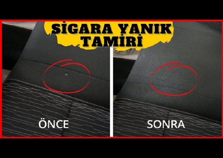 Sigara Yanık Tamiri